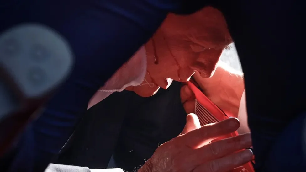 The image captures a close-up moment during a sports event, likely rugby, featuring an individual with short hair leaning forward with a focused expression. They appear to be attending to something out of frame, potentially dealing with an injury, as there's a noticeable trail of sweat or possibly blood running down the face. The lighting is intense, casting strong shadows and highlighting the person's features. The background is blurred, focusing attention on the central figure. Attire includes sports clothing, primarily in red and blue, indicating team colors. The image conveys a sense of urgency and concentration, with the angled composition adding to the dynamic feel of the scene. The presence of other figures, partially visible, suggests a supportive or medical role, contributing to the atmosphere of care and immediacy.