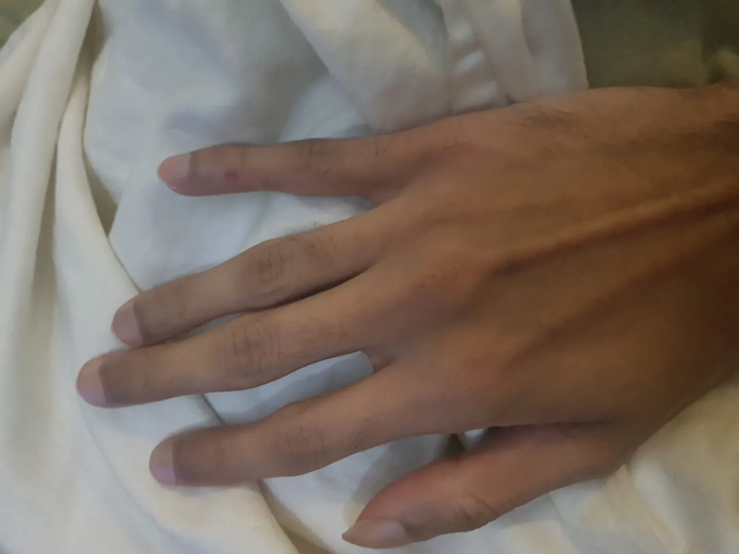 The image shows a close-up of a human hand resting on a white fabric. The hand is positioned palm down with fingers spread slightly apart. The skin tone is light to medium, and the hand appears to be relaxed. The background consists of creased white fabric, possibly part of a garment or a bed sheet, adding a soft and casual ambiance to the image. The lighting is gentle and slightly diffused, which enhances the texture of the skin and fabric. There's a small mark visible on the middle finger, possibly a bruise or a minor blemish. The veins on the back of the hand are subtly visible, and the nails appear well-groomed. The overall mood of the image is calm and natural.