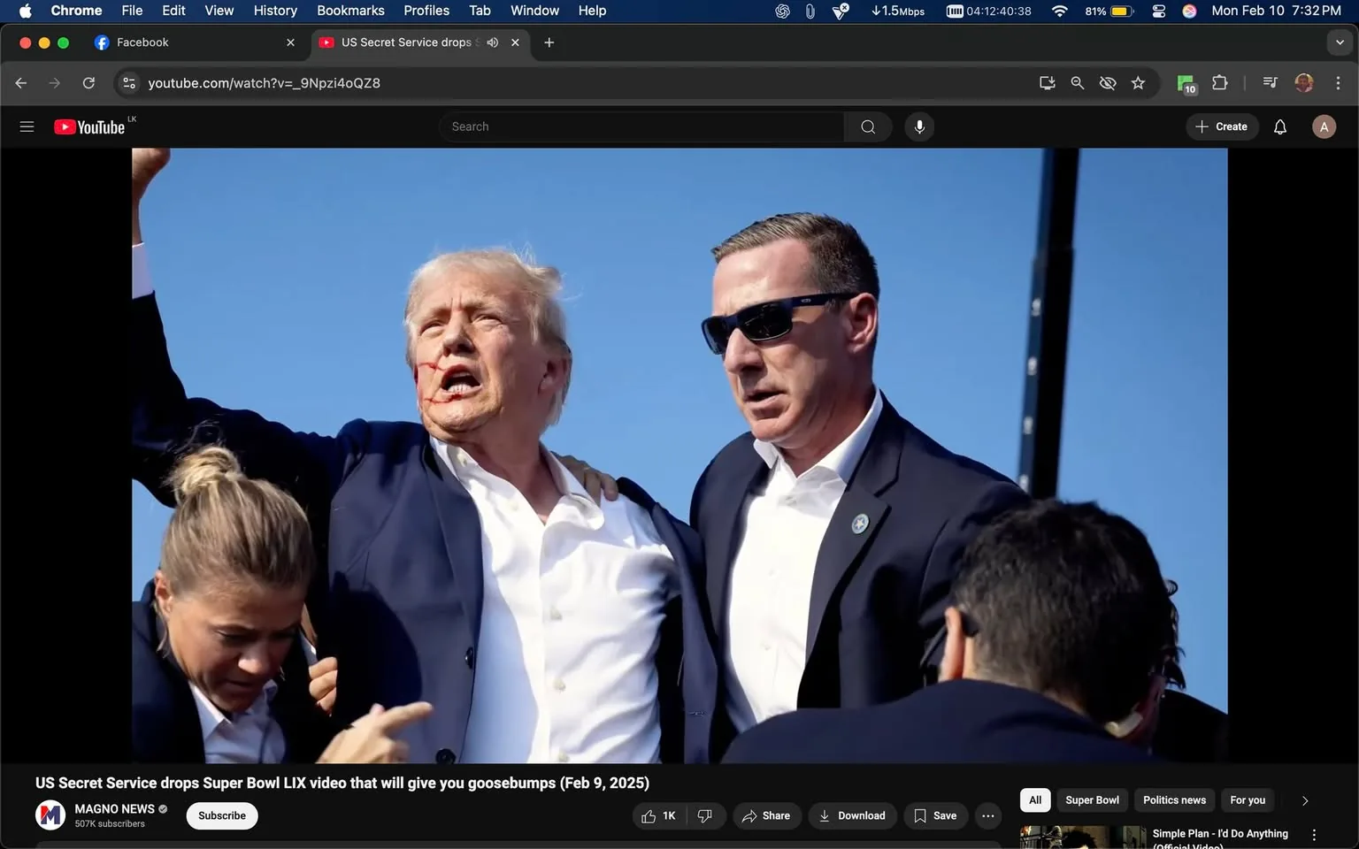 The image depicts a scene with several individuals, prominently featuring a man who appears to be a public figure, possibly Donald Trump, based on his distinctive hairstyle and facial features. He is wearing a dark suit jacket over a white shirt, which is partially unbuttoned. His expression appears intense, with his mouth open as if he is speaking or shouting. There is visible blood on his face, specifically around his mouth, suggesting he may have been injured.

To his right stands another man, who is wearing sunglasses and a dark suit. He appears to be providing support or protection to the first individual. The man in sunglasses has a serious expression and is looking forward, seemingly focused on the situation. 

In the background, there is a woman who is partially visible, wearing a dark jacket and looking down, possibly attending to something or someone. Her hair is styled in loose waves. 

The setting appears to be outdoors, with a clear blue sky in the background, indicating it might be a public event or rally. There are no visible signs, logos, or text in the immediate vicinity that can be read. The overall atmosphere suggests a moment of heightened emotion or urgency, but no specific context or event is identifiable from the image alone. 

The image is framed in a way that emphasizes the individuals in the foreground, with a blurred background that does not provide additional context about the location or event.