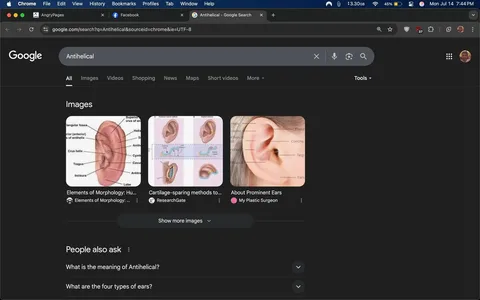The image displays a Google search results page for the term "Antihelical." The background is dark, typical of a night mode interface. At the top, the search bar shows the term "Antihelical" with a small icon indicating the search source. Below the search bar, there are several images related to ear anatomy. 

1. The first image is a detailed anatomical diagram of an ear, labeling parts such as the "superior crus of antihelix," "tragus," and "incisura."
2. The second image features illustrations demonstrating cartilage-sparing methods, likely in the context of ear surgery.
3. The third image shows a close-up of an ear with labeled parts, including "fossa" and "concha."

Under the images, there are questions like "What is the meaning of Antihelical?" and "What are the four types of ears?" The overall tone is educational, focusing on anatomical and surgical aspects of ear structure. No identifiable individuals or sensitive content are present.